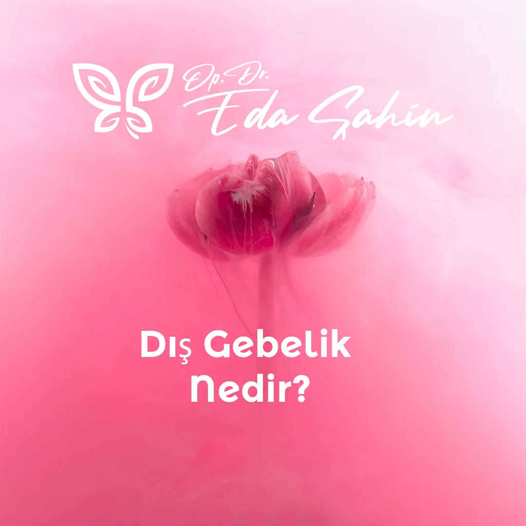 Dış Gebelik Nedir?