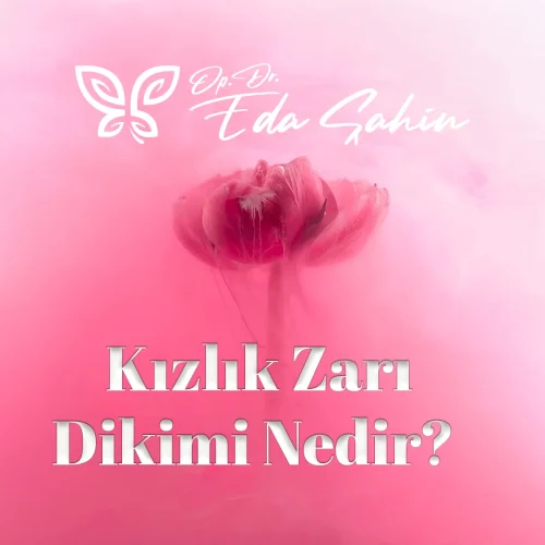 Kızlık Zarı Dikimi