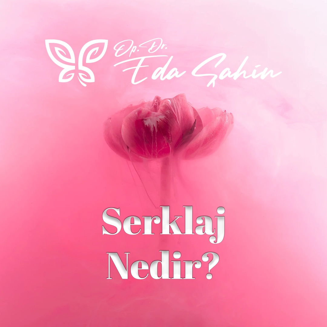 Serklaj Nedir